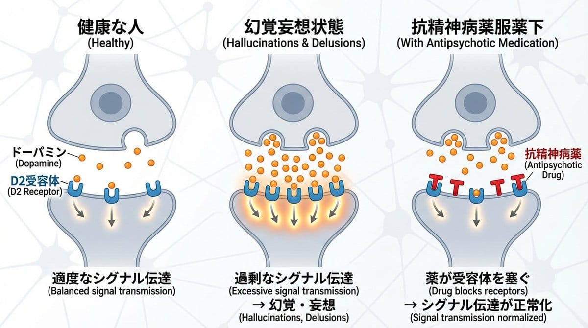 多巴胺与精神分裂症：D2受体作用机制图解